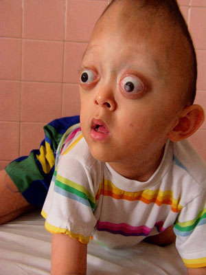 Dioxin-victim-by-Daniel-Shea