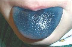 supertaster-test-blue-tongue-