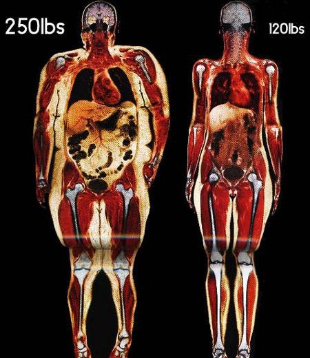 world's-apart-with-health-risk