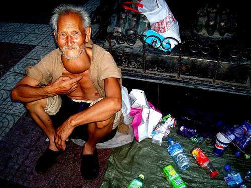 tanned-goiter-seen-in-chinese-older-male
