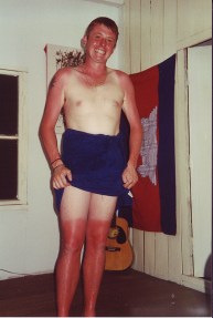 niacin-flush-guy-really-badly-sunburn